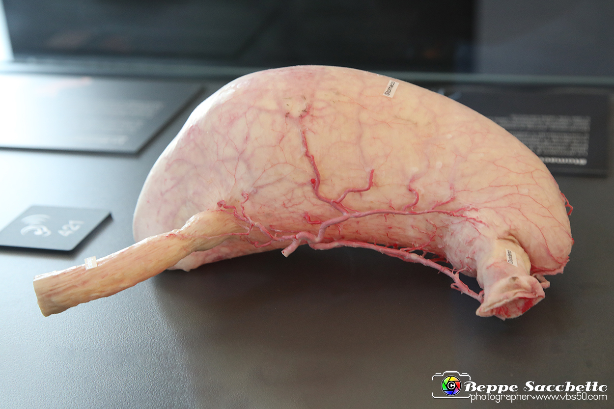 VBS_2772 Stomaco - Mostra Body Worlds.jpg